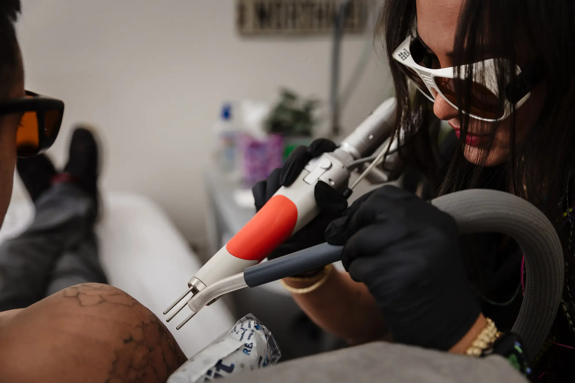 Laser specialist in protective eyewear guiding a Q-Switched tattoo removal handpiece over a client's tattooed leg at Wichita Laser Clinic